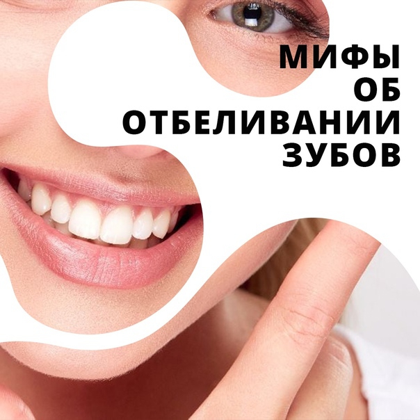 Правда и мифы об отбеливании зубов