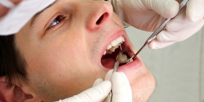Что такое гранулема зубов?