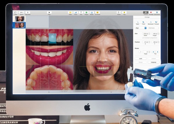  Цифровые технологии как гарантия качества при лечении и протезировании зубов