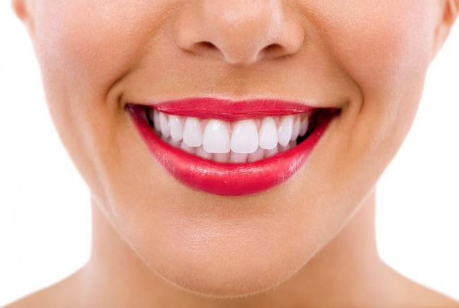 Фотоотбеливание зубов: эффективный подход