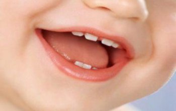 Нужно ли лечить молочные (временные) зубы?