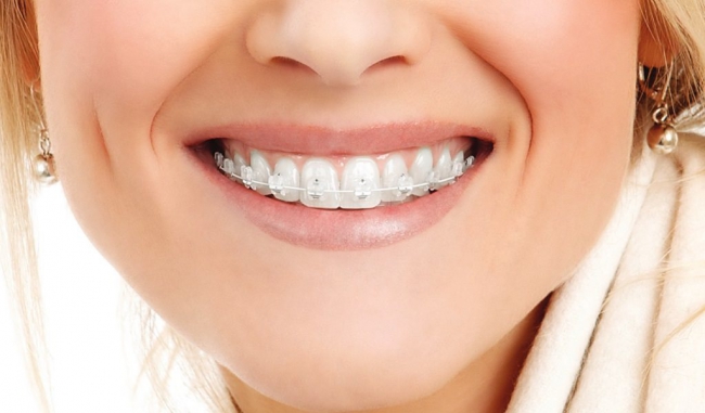 Ортодонтическое лечение в стоматологии