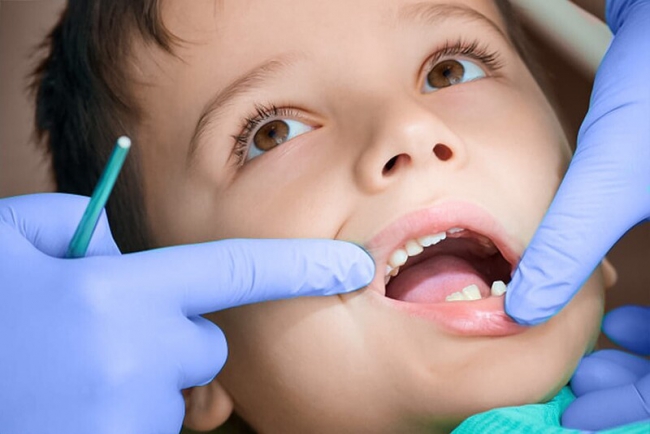 Почему у ребенка плохие гнилые зубы: 13 причин и спасение