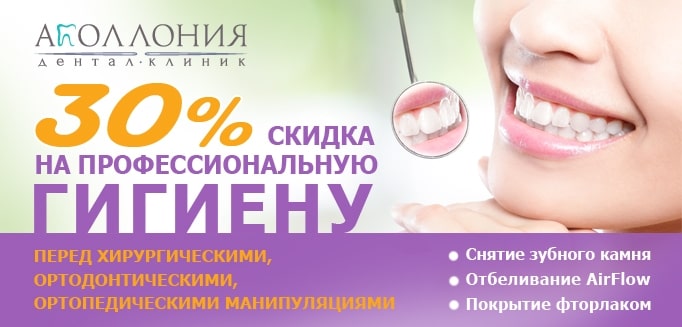 30% скидка на профессиональную гигиену перед стоматологическими манипуляциями.